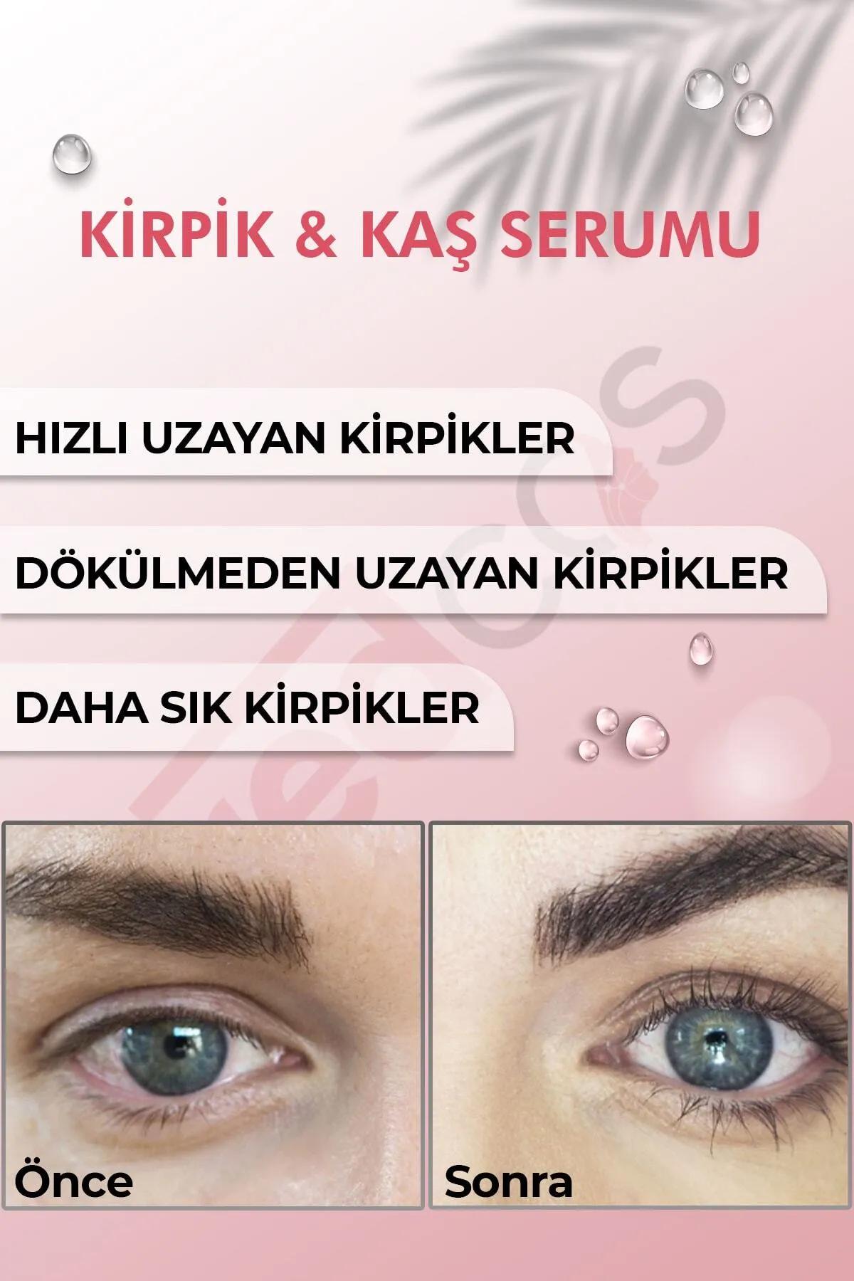 Ürün Resmi 3